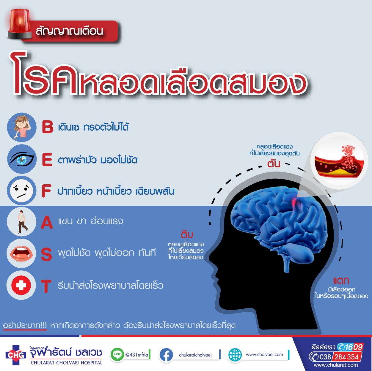 อย่าประมาท !! ตีบ ตัน แตก ตาย - ความรู้สุขภาพ - โรงพยาบาลจุฬารัตน์ชลเวช