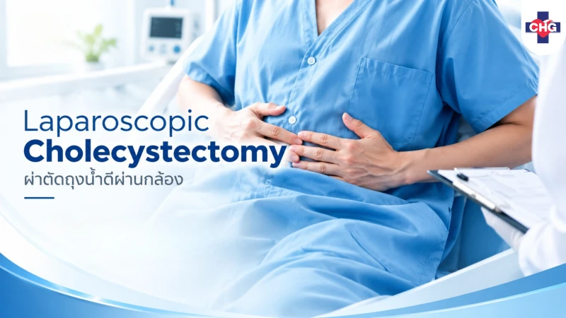 การผ่าตัดถุงน้ำดีผ่านกล้อง Laparoscopic Cholecystectomy