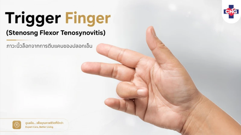 Trigger Finger (Stenosing Flexor Tenosynovitis): ภาวะนิ้วล็อกจากการตีบแคบของปลอกเอ็น