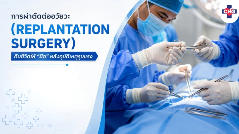 การผ่าตัดต่ออวัยวะ (Replantation Surgery) : คืนชีวิตให้ “มือ” หลังอุบัติเหตุรุนแรง