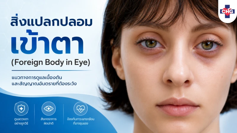 สิ่งแปลกปลอมเข้าตา (Foreign Body in Eye): แนวทางการดูแลเบื้องต้นและสัญญาณอันตรายที่ต้องระวัง