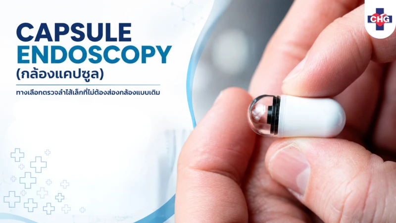 Capsule Endoscopy (กล้องแคปซูล): ทางเลือกตรวจลำไส้เล็กที่ไม่ต้องส่องกล้องแบบเดิม
