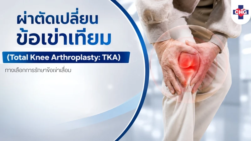ผ่าตัดเปลี่ยนข้อเข่าเทียม (Total Knee Arthroplasty: TKA) ทางเลือกการรักษาข้อเข่าเสื่อม