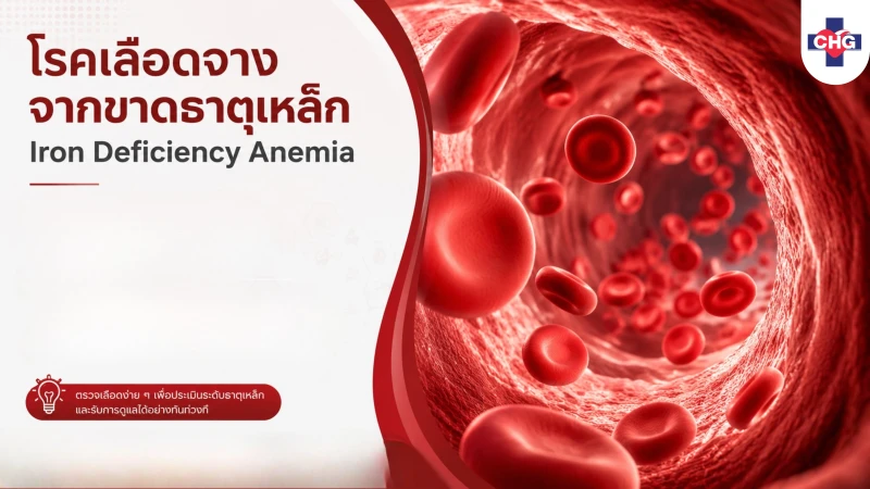 โรคเลือดจางจากขาดธาตุเหล็ก (Iron Deficiency Anemia)